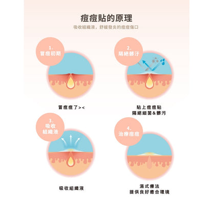 【優若美】MaySkin 隱形痘痘貼 透薄30入/透薄60入/吸收++12入/透薄24入吸收++9入