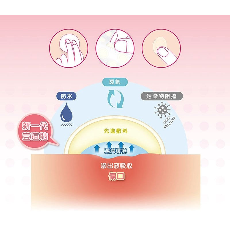 【3M】Nexcare 痘痘隱形貼(綜合型) 36入/盒 痘痘貼 隔絕髒污 有效吸收 親水性敷料