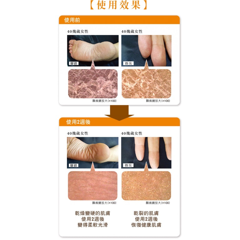 【悠斯晶Yuskin】悠斯晶乳霜 試用包 3g/包 台灣公司貨 Yuskin乳霜 手足霜 護手霜 護足霜