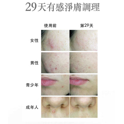 【豐傑生醫】水楊酸抗痘機能沐浴露 經典/女香500ml/瓶 美背 痘痘肌