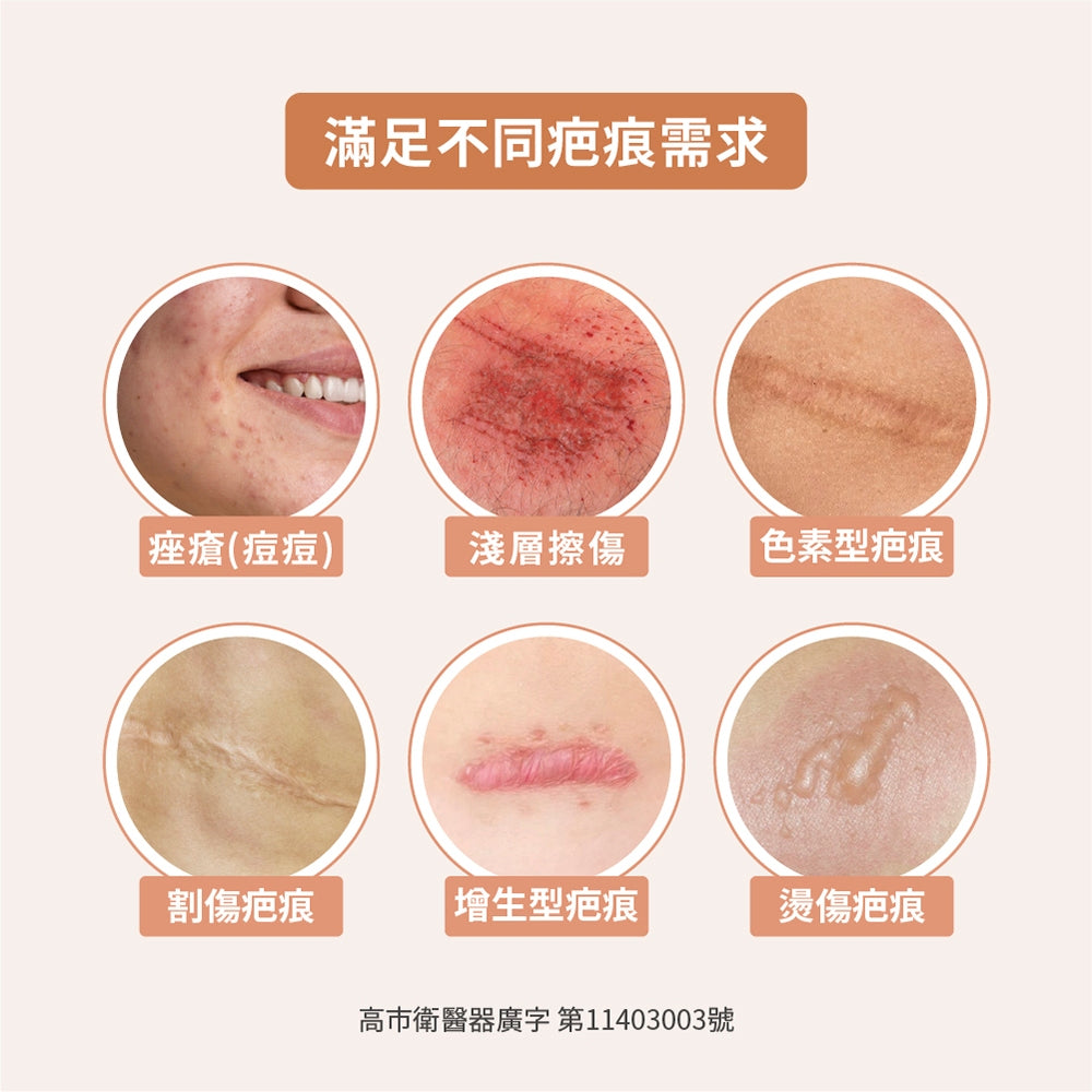 【TAICEND】泰陞疤痕凝膠 10g/盒 獨家專利技術