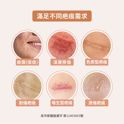 【TAICEND】泰陞疤痕凝膠 10g/盒 獨家專利技術