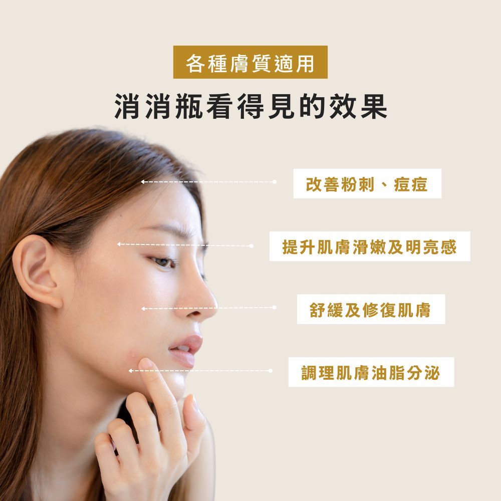 【BFFECT】消消瓶-2%水楊酸粉刺調理精華 30ml/盒