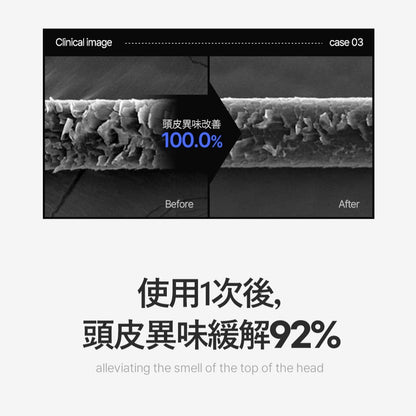 【SMIB】1000億乳酸菌頭皮淨化三效調理慕斯 190g/盒 蘋果醋 頭皮保養 溫和淨化 去除異味