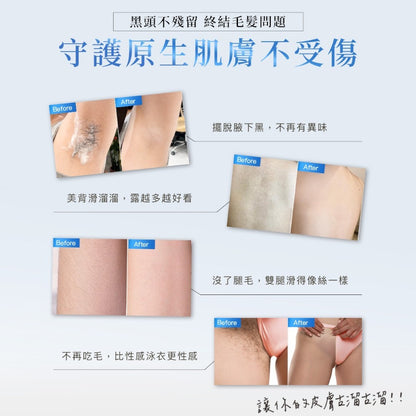 【黛后】私密花園專用除草霜 100ml 脫護合一 零痛感 溫和植萃配方 日常保養 私密肌適用 Dr.hold