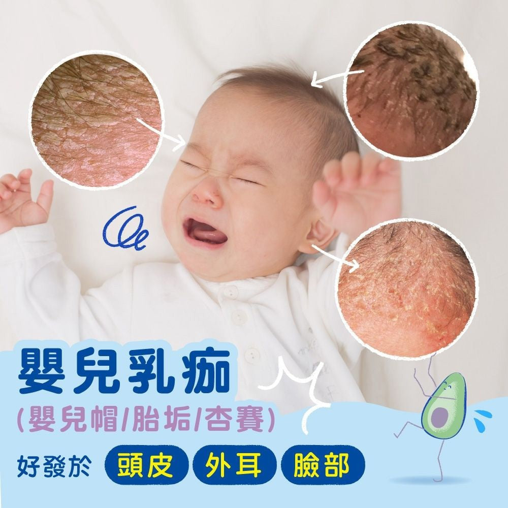 【慕之恬廊】慕之幼潔髮慕絲 150ml 清潔胎垢乳痂 葵花子油 酪梨多酚 99%天然萃取 頭皮照護 洗髮