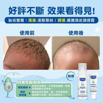 【慕之恬廊】慕之幼潔髮慕絲 150ml 清潔胎垢乳痂 葵花子油 酪梨多酚 99%天然萃取 頭皮照護 洗髮